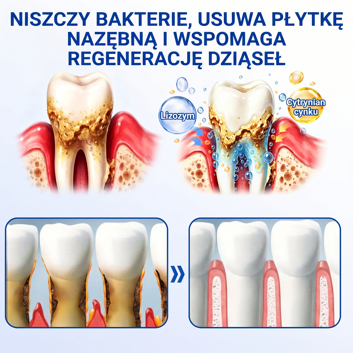 Zoencgz® 🦷🍑 Żel antybakteryjny do regeneracji dziąseł | Widoczne efekty w 7 dni